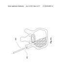 TWO-PART BONE CEMENT COMPOSITE CONTAINING PARTICLES IN A NON-UNIFORM SPATIAL DISTRIBUTION AND DEVICES FOR IMPLEMENTATION diagram and image