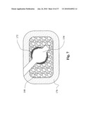 TWO-PART BONE CEMENT COMPOSITE CONTAINING PARTICLES IN A NON-UNIFORM SPATIAL DISTRIBUTION AND DEVICES FOR IMPLEMENTATION diagram and image