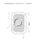 TWO-PART BONE CEMENT COMPOSITE CONTAINING PARTICLES IN A NON-UNIFORM SPATIAL DISTRIBUTION AND DEVICES FOR IMPLEMENTATION diagram and image