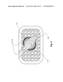 TWO-PART BONE CEMENT COMPOSITE CONTAINING PARTICLES IN A NON-UNIFORM SPATIAL DISTRIBUTION AND DEVICES FOR IMPLEMENTATION diagram and image