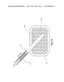 TWO-PART BONE CEMENT COMPOSITE CONTAINING PARTICLES IN A NON-UNIFORM SPATIAL DISTRIBUTION AND DEVICES FOR IMPLEMENTATION diagram and image