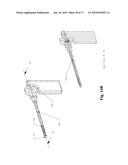 TWO-PART BONE CEMENT COMPOSITE CONTAINING PARTICLES IN A NON-UNIFORM SPATIAL DISTRIBUTION AND DEVICES FOR IMPLEMENTATION diagram and image