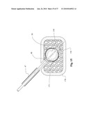 TWO-PART BONE CEMENT COMPOSITE CONTAINING PARTICLES IN A NON-UNIFORM SPATIAL DISTRIBUTION AND DEVICES FOR IMPLEMENTATION diagram and image