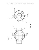 TWO-PART BONE CEMENT COMPOSITE CONTAINING PARTICLES IN A NON-UNIFORM SPATIAL DISTRIBUTION AND DEVICES FOR IMPLEMENTATION diagram and image