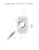 TWO-PART BONE CEMENT COMPOSITE CONTAINING PARTICLES IN A NON-UNIFORM SPATIAL DISTRIBUTION AND DEVICES FOR IMPLEMENTATION diagram and image