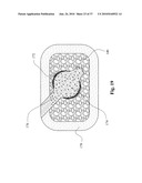 TWO-PART BONE CEMENT COMPOSITE CONTAINING PARTICLES IN A NON-UNIFORM SPATIAL DISTRIBUTION AND DEVICES FOR IMPLEMENTATION diagram and image