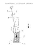 TWO-PART BONE CEMENT COMPOSITE CONTAINING PARTICLES IN A NON-UNIFORM SPATIAL DISTRIBUTION AND DEVICES FOR IMPLEMENTATION diagram and image