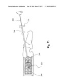 TWO-PART BONE CEMENT COMPOSITE CONTAINING PARTICLES IN A NON-UNIFORM SPATIAL DISTRIBUTION AND DEVICES FOR IMPLEMENTATION diagram and image