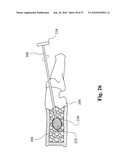 TWO-PART BONE CEMENT COMPOSITE CONTAINING PARTICLES IN A NON-UNIFORM SPATIAL DISTRIBUTION AND DEVICES FOR IMPLEMENTATION diagram and image