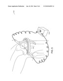 Apparatus and Method for Aiming a Surgical Tool diagram and image