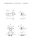 DEVICES, METHODS, AND KITS FOR GASTROINTESTINAL PROCEDURES diagram and image