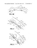 DEVICES, METHODS, AND KITS FOR GASTROINTESTINAL PROCEDURES diagram and image