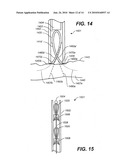 DEVICES, METHODS, AND KITS FOR GASTROINTESTINAL PROCEDURES diagram and image