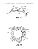 DEVICES, METHODS, AND KITS FOR GASTROINTESTINAL PROCEDURES diagram and image