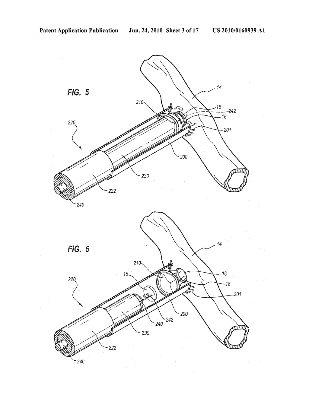 SYSTEMS, APPARATUSES, AND METHODS FOR CARDIOVASCULAR CUTTING DEVICES AND VALVES - diagram, schematic, and image 04