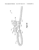 ONE-HANDED LOOP TOURNIQUET diagram and image