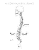 SYSTEMS AND METHODS FOR PEDICLE SCREW-BASED SPINE STABILIZATION USING FLEXIBLE BANDS diagram and image