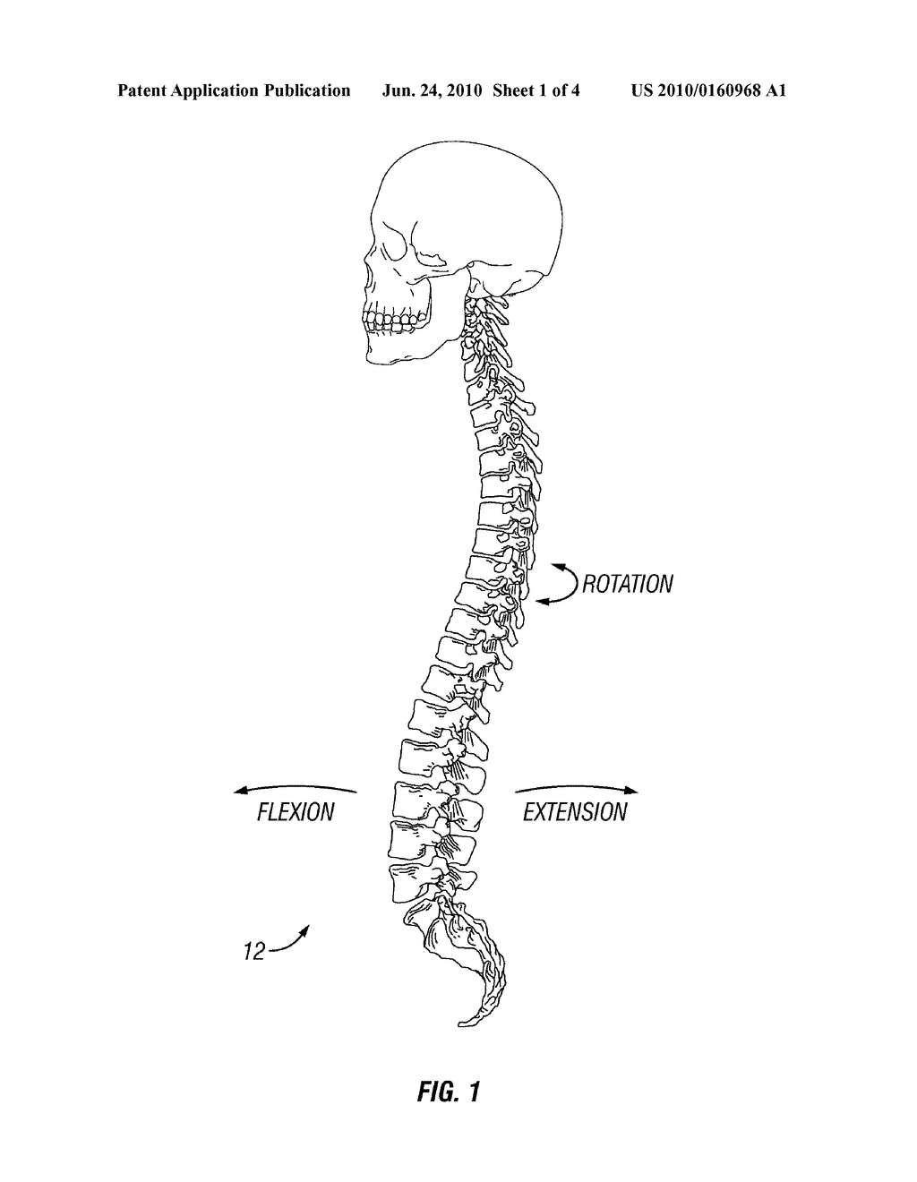SYSTEMS AND METHODS FOR PEDICLE SCREW-BASED SPINE STABILIZATION USING FLEXIBLE BANDS - diagram, schematic, and image 02
