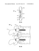 SYSTEMS AND METHODS FOR PEDICLE SCREW-BASED SPINE STABILIZATION USING FLEXIBLE BANDS diagram and image