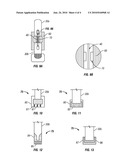 SYSTEMS AND METHODS FOR PEDICLE SCREW-BASED SPINE STABILIZATION USING FLEXIBLE BANDS diagram and image