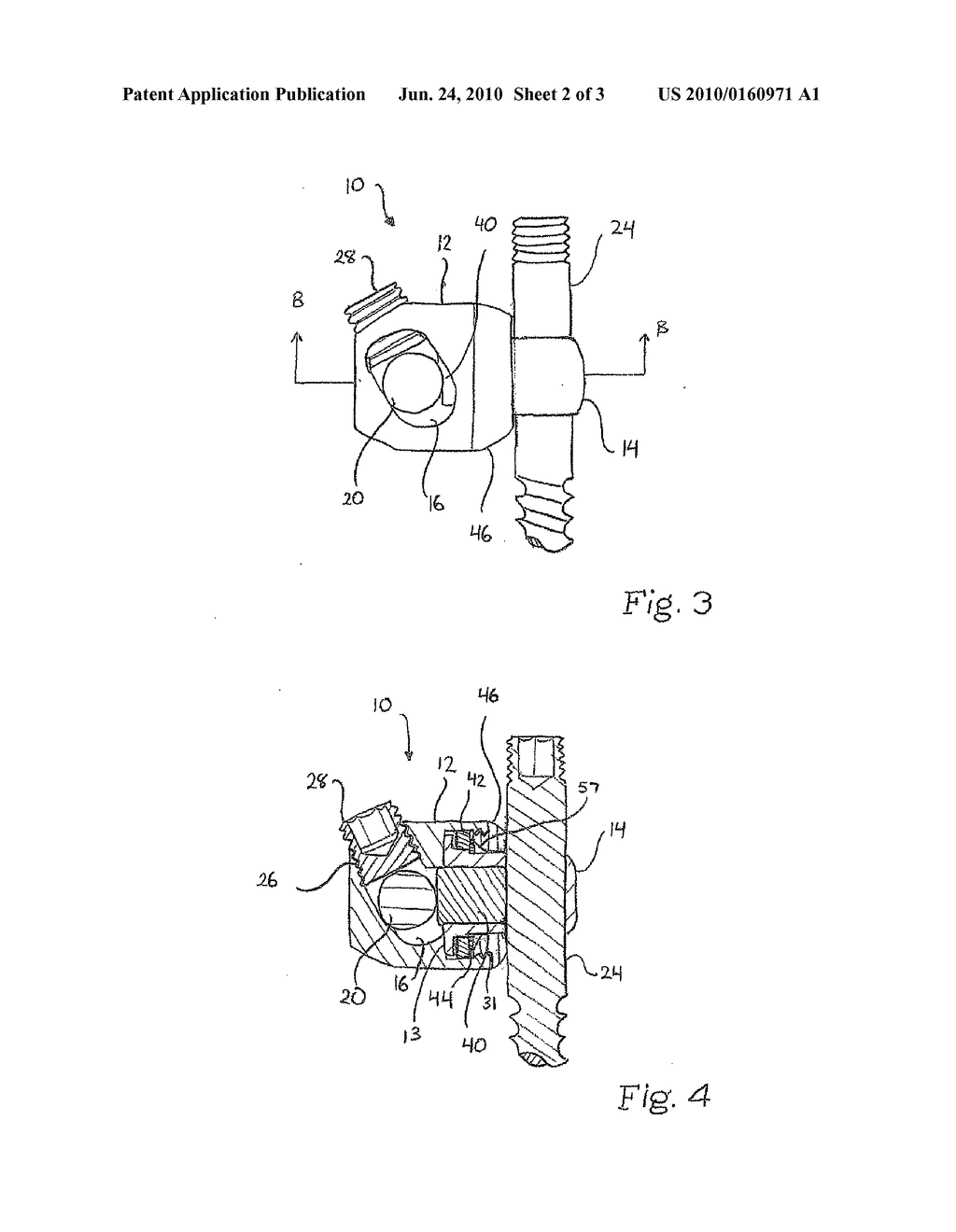 Variable Angle Connection Assembly - diagram, schematic, and image 03