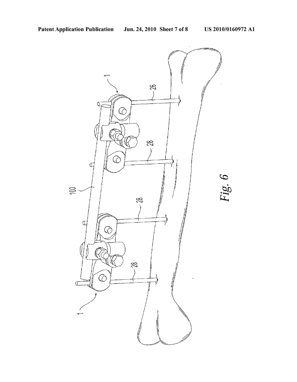 Multi-Pin Clamp and Rod Attachmenton - diagram, schematic, and image 08