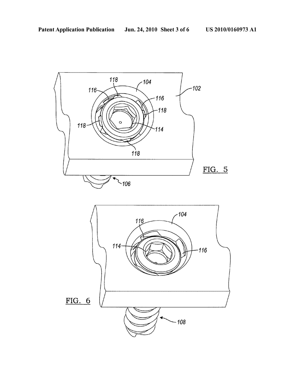 BONE FIXATION ASSEMBLY - diagram, schematic, and image 04