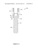 Method of Bone Anchor Assembly diagram and image