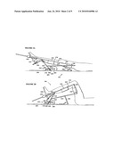 UPPER EXTREMITY MUSCLE THERAPY SYSTEM diagram and image