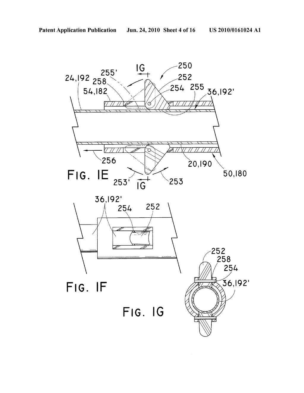 OVER THE ENDOSCOPE INTRODUCER FOR STENTS - diagram, schematic, and image 05