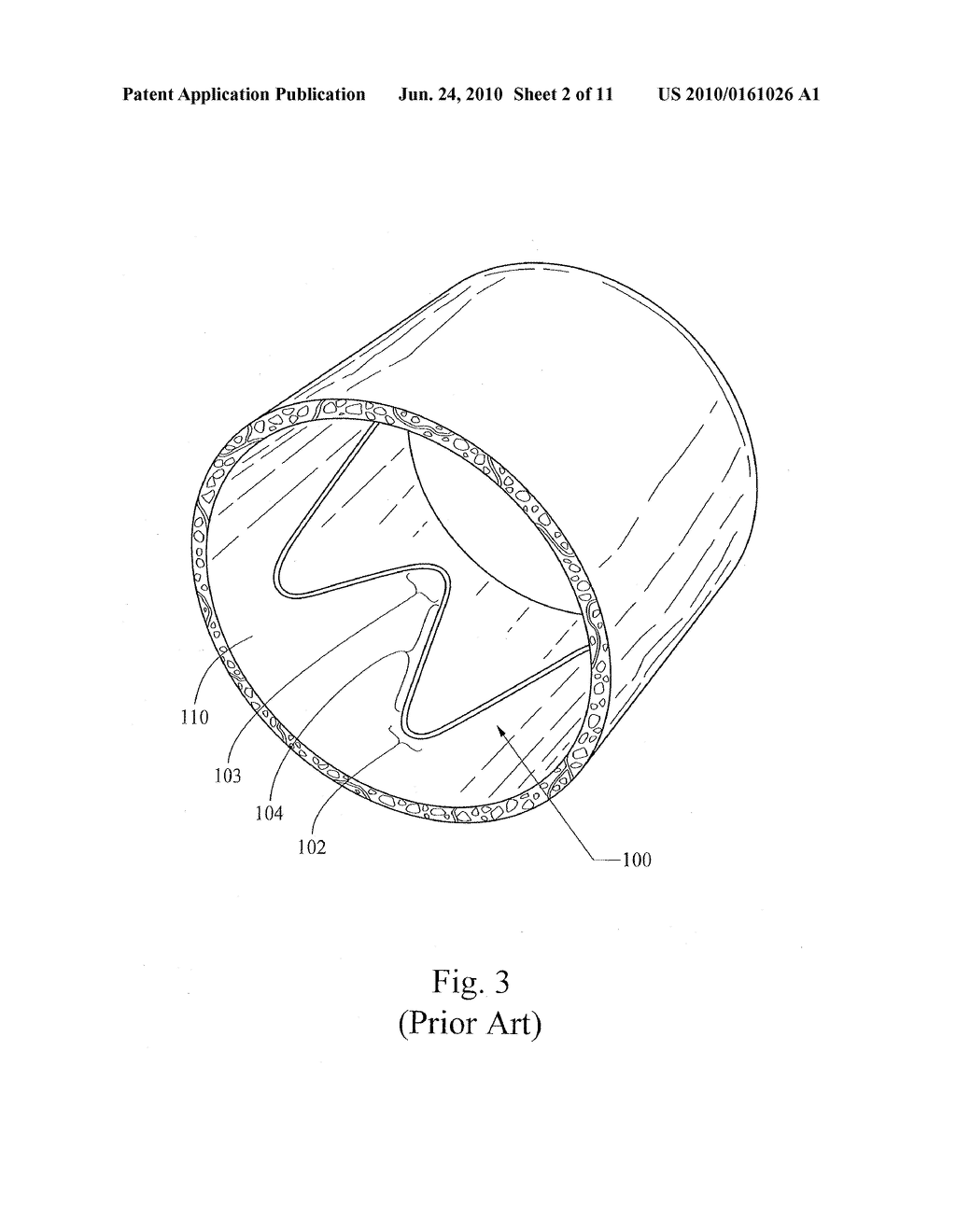 LOW PROFILE NON-SYMMETRICAL STENT - diagram, schematic, and image 03