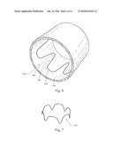 LOW PROFILE NON-SYMMETRICAL STENT diagram and image