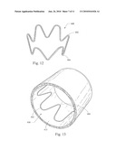 LOW PROFILE NON-SYMMETRICAL STENT diagram and image