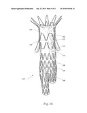 LOW PROFILE NON-SYMMETRICAL STENT diagram and image