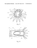 LOW PROFILE NON-SYMMETRICAL STENT diagram and image