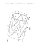 STENT AND STENT-GRAFT HAVING ONE OR MORE CONFORMANCE STRUTS diagram and image