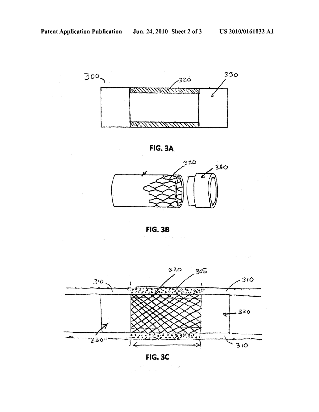 BIOLOGICALLY ENGINEERED STENT - diagram, schematic, and image 03