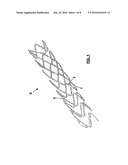 ENDOVASCULAR PROSTHESIS AND RELATING MANUFACTURING PROCEDURE diagram and image