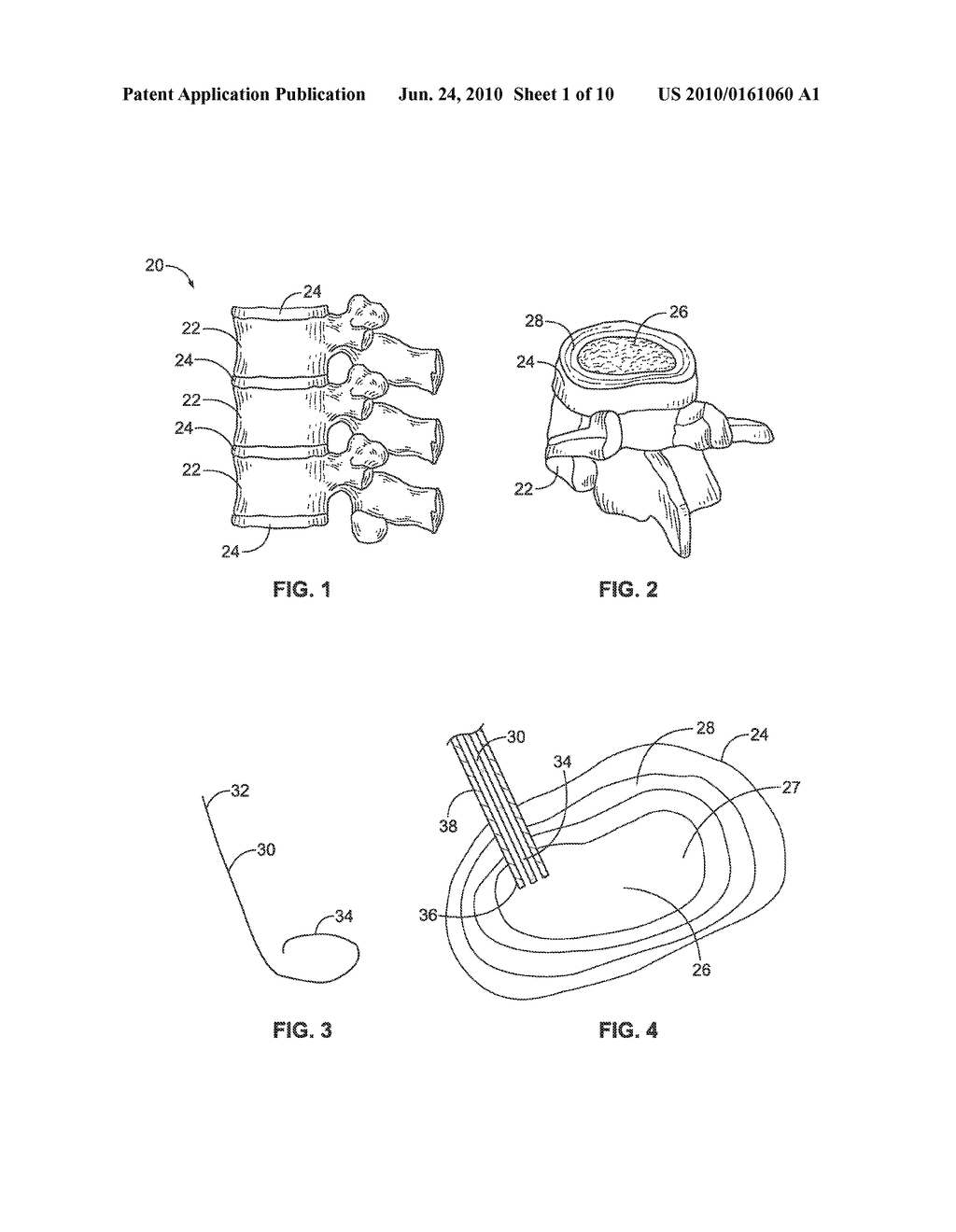 Tissue Removal Tools And Methods Of Use - diagram, schematic, and image 02