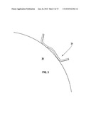 Prosthetic joint diagram and image