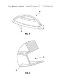 Prosthetic joint diagram and image