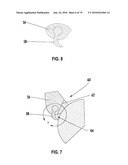 Prosthetic joint diagram and image