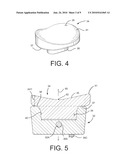 Shoulder Prosthesis with Vault-Filling Structure having Bone-Sparing Configuration diagram and image