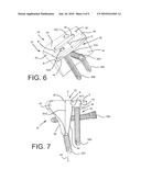 Shoulder Prosthesis with Vault-Filling Structure having Bone-Sparing Configuration diagram and image