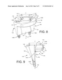 Shoulder Prosthesis with Vault-Filling Structure having Bone-Sparing Configuration diagram and image