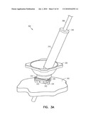 Ball and Socket Trajectory Guide diagram and image