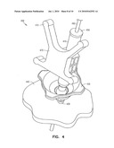 Ball and Socket Trajectory Guide diagram and image