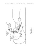 Methods and apparatus for safe application of an intubation device diagram and image