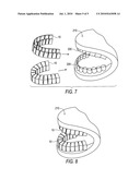 Dental Shield Device diagram and image