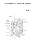 Systems, devices, and methods for making or administering frozen particles diagram and image